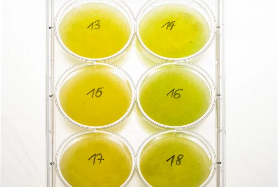 Bakterien und Schimmelpilzkulturen in einer Petrischale